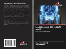 Liposarcoma dei tessuti molli的封面