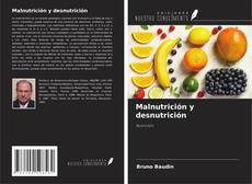 Couverture de Malnutrición y desnutrición