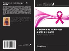 Buchcover von Carcinomas mucinosos puros de mama