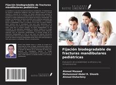 Buchcover von Fijación biodegradable de fracturas mandibulares pediátricas