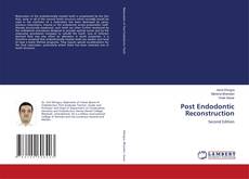 Bookcover of Post Endodontic Reconstruction