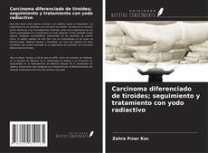 Couverture de Carcinoma diferenciado de tiroides; seguimiento y tratamiento con yodo radiactivo