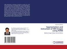 Couverture de Segmentation and Extraction of MR Images using PCNN
