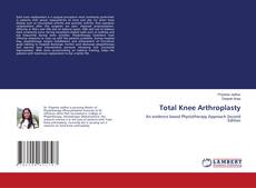 Bookcover of Total Knee Arthroplasty