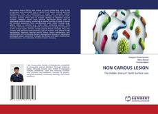 NON CARIOUS LESION的封面