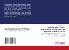 Couverture de Beyond the Flakes: Malassezia furfur and the Quest for Healthy Hair