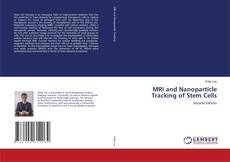 Portada del libro de MRI and Nanoparticle Tracking of Stem Cells