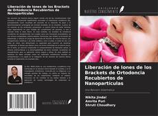 Copertina di Liberación de Iones de los Brackets de Ortodoncia Recubiertos de Nanopartículas