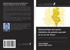 Copertina di Epidemiología del quiste hidatídico de pulmón operado en el sur de Túnez