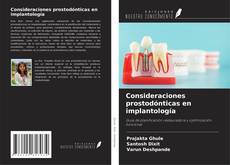 Copertina di Consideraciones prostodónticas en implantología