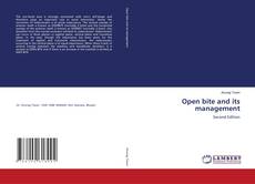 Bookcover of Open bite and its management
