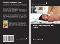 Copertina di Apnea obstructiva del sueño