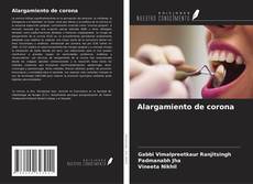 Buchcover von Alargamiento de corona