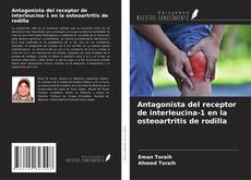 Couverture de Antagonista del receptor de interleucina-1 en la osteoartritis de rodilla