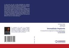 Couverture de Immediate Implants