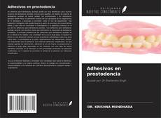 Buchcover von Adhesivos en prostodoncia