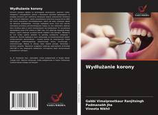 Bookcover of Wydłużanie korony