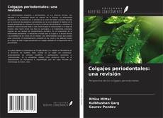 Couverture de Colgajos periodontales: una revisión