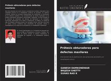Buchcover von Prótesis obturadoras para defectos maxilares