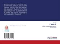 Bookcover of Psoriasis