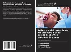 Buchcover von Influencia del tratamiento de ortodoncia en las raíces de dientes autotrasplantados