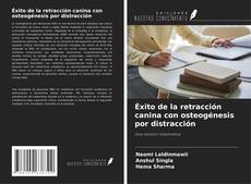 Copertina di Éxito de la retracción canina con osteogénesis por distracción