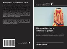Buchcover von Biomarcadores en la inflamación pulpar
