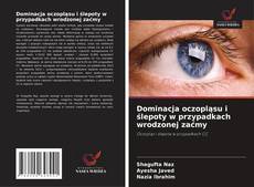 Bookcover of Dominacja oczopląsu i ślepoty w przypadkach wrodzonej zaćmy