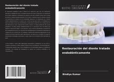 Buchcover von Restauración del diente tratado endodónticamente