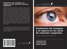 Copertina di Predominio del nistagmo y la ceguera en los casos de cataratas congénitas
