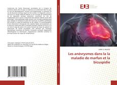 Buchcover von Les anévrysmes dans la la maladie de marfan et la bicuspidie