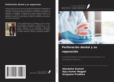 Couverture de Perforación dental y su reparación