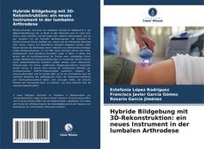Hybride Bildgebung mit 3D-Rekonstruktion: ein neues Instrument in der lumbalen Arthrodese kitap kapağı