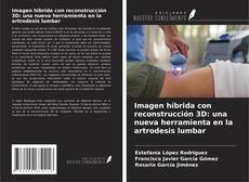 Buchcover von Imagen híbrida con reconstrucción 3D: una nueva herramienta en la artrodesis lumbar
