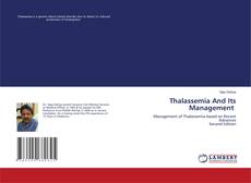 Bookcover of Thalassemia And Its Management