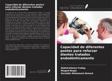 Capa do livro de Capacidad de diferentes postes para reforzar dientes tratados endodónticamente 