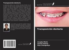 Buchcover von Transposición dentaria