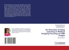 Bookcover of An Overview of Deep Learning in Medical Imaging Focusing on MRI images
