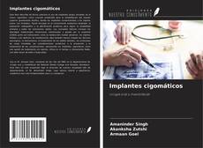 Capa do livro de Implantes cigomáticos 