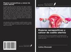 Buchcover von Mujeres seropositivas y cáncer de cuello uterino