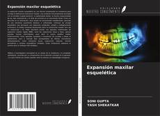 Buchcover von Expansión maxilar esquelética