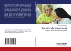 Copertina di Dental Implant Abutments