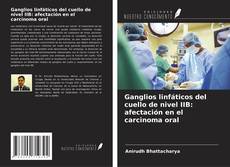 Copertina di Ganglios linfáticos del cuello de nivel IIB: afectación en el carcinoma oral