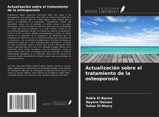 Copertina di Actualización sobre el tratamiento de la osteoporosis