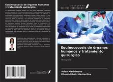Equinococosis de órganos humanos y tratamiento quirúrgico的封面