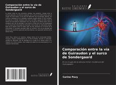Buchcover von Comparación entre la vía de Guiraudon y el surco de Sondergaard