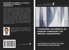 Couverture de Trombofilia hereditaria en mujeres sudanesas con abortos espontáneos