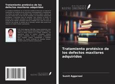 Copertina di Tratamiento protésico de los defectos maxilares adquiridos