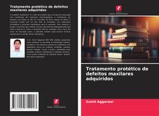 Buchcover von Tratamento protético de defeitos maxilares adquiridos