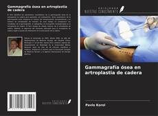 Copertina di Gammagrafía ósea en artroplastia de cadera